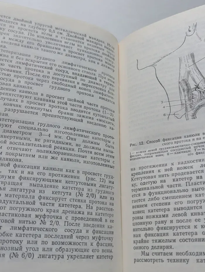 Лимфология эндотоксикоза