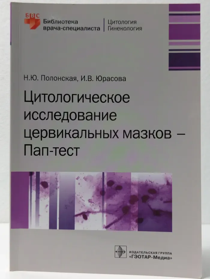 Цитологическое исследование цервикальных мазков – Пап-тест