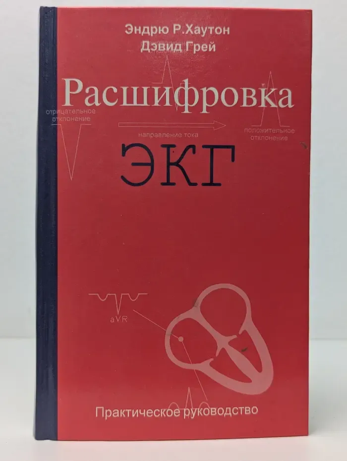 Расшифровка ЭКГ