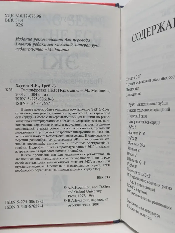Расшифровка ЭКГ