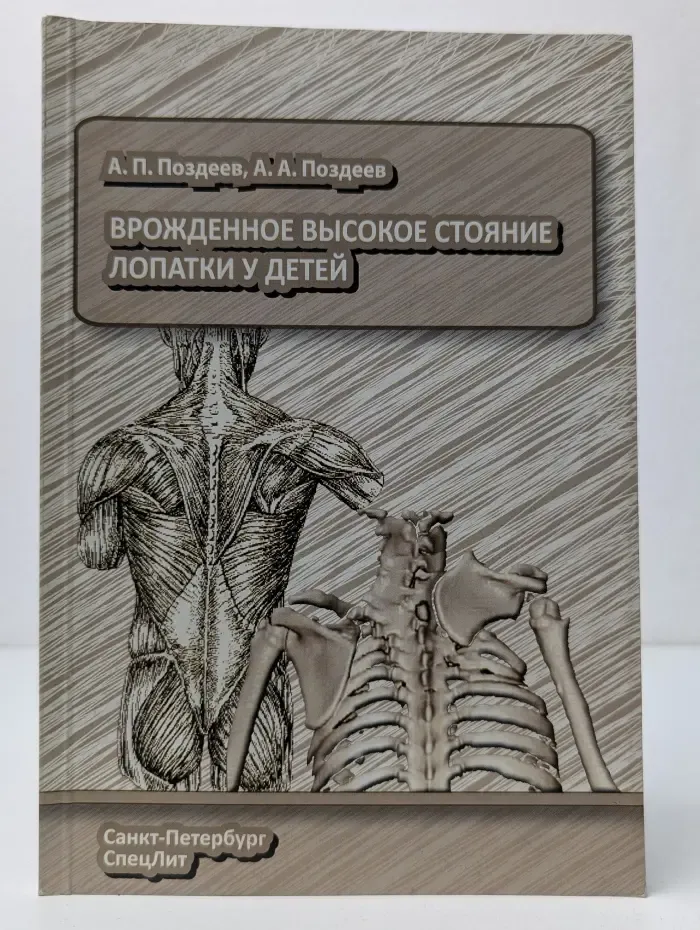Врожденное высокое стояние лопатки у детей