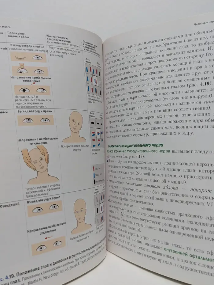 Топический диагноз в неврологии по Петеру Дуусу. Анатомия, физиология, клиника