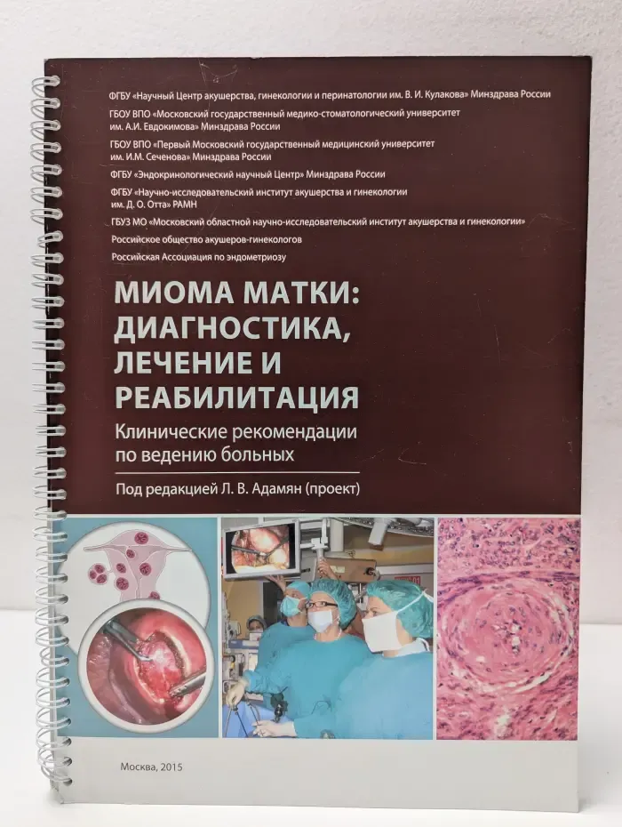 Миома матки. Диагностика, лечение и реабилитация
