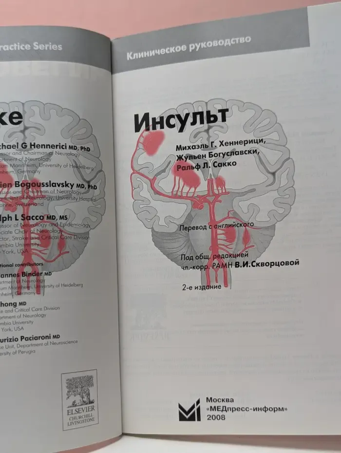 Инсульт