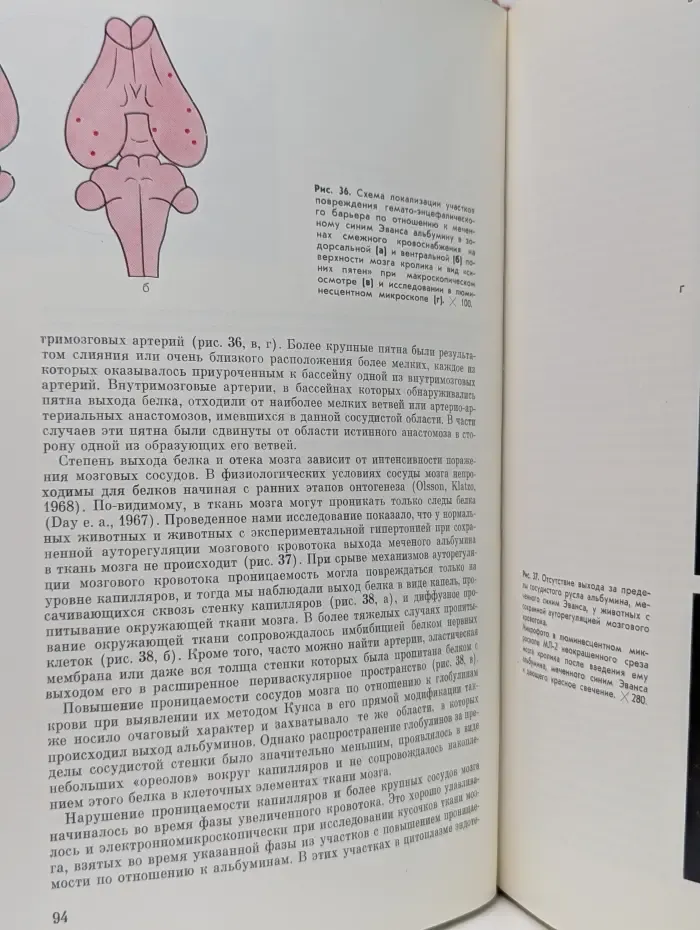 Сосудистые заболевания нервной системы