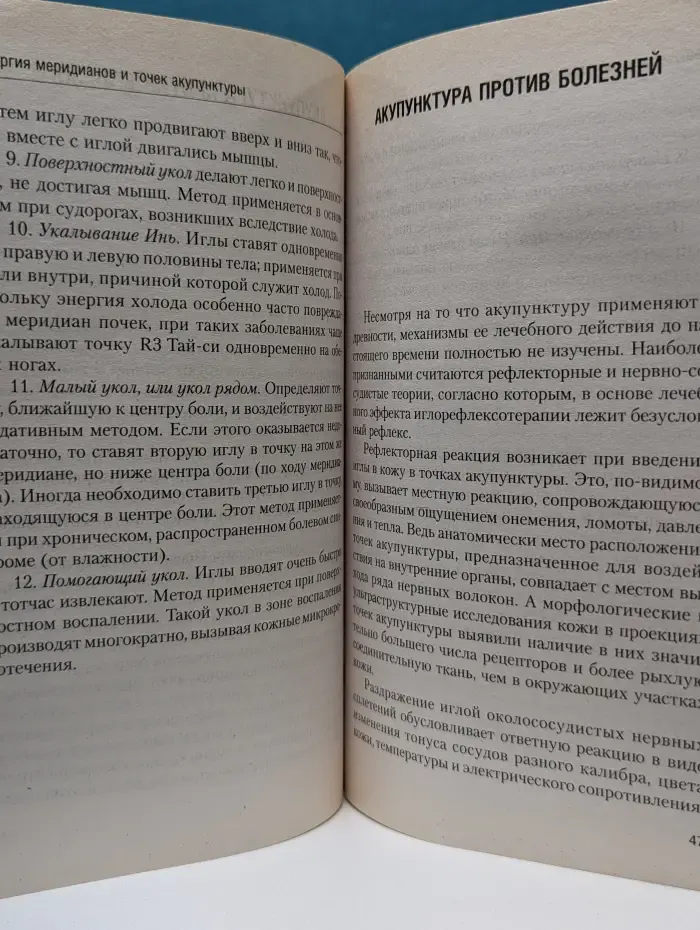 Акупунктура