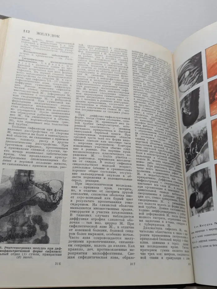 Большая медицинская энциклопедия. Том 8