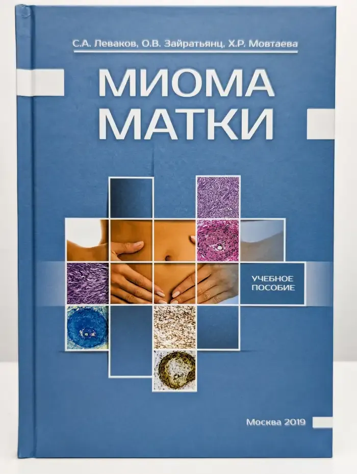 Миома матки. Учебное пособие