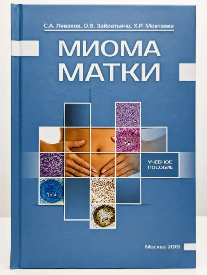 Миома матки. Учебное пособие