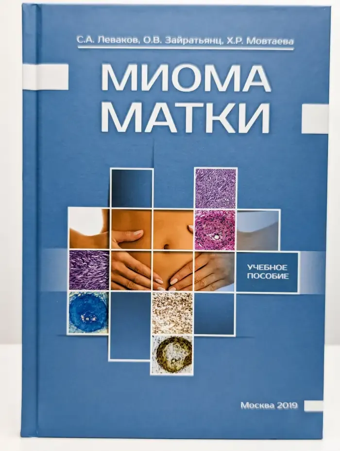 Миома матки. Учебное пособие