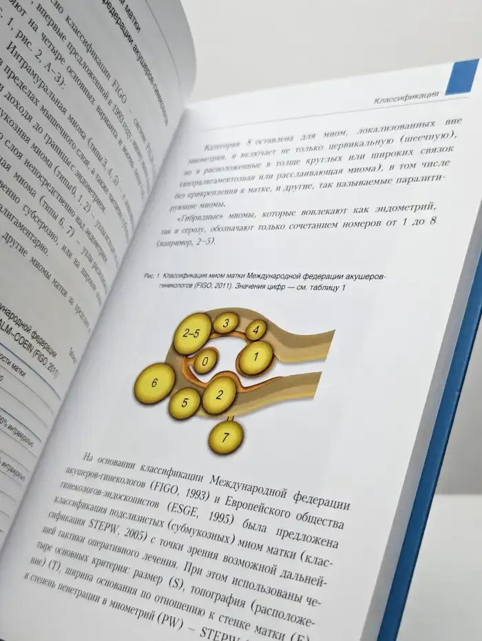 Миома матки. Учебное пособие
