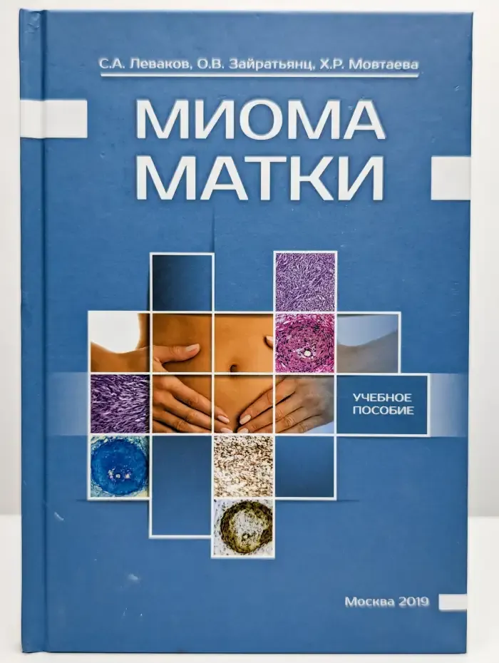 Миома матки. Учебное пособие