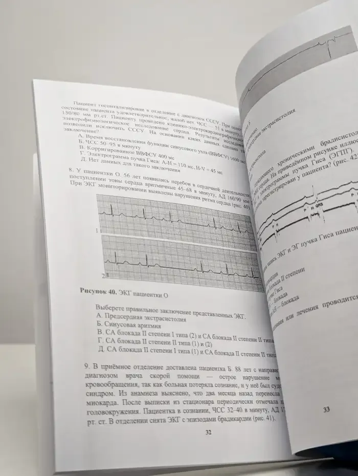 Брадиаритмии. Диагностика и лечение