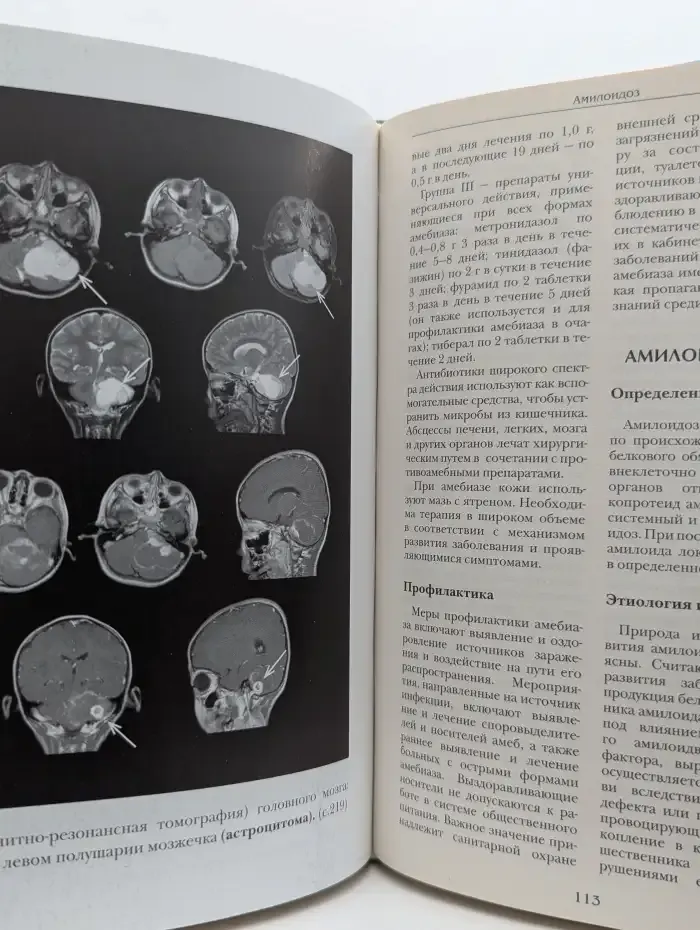 Большая медицинская энциклопедия. Том 1