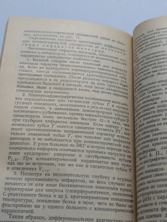 Кардиалгии