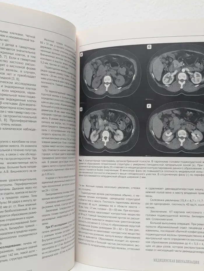 Медицинская визуализация. Выпуск № 1/2010