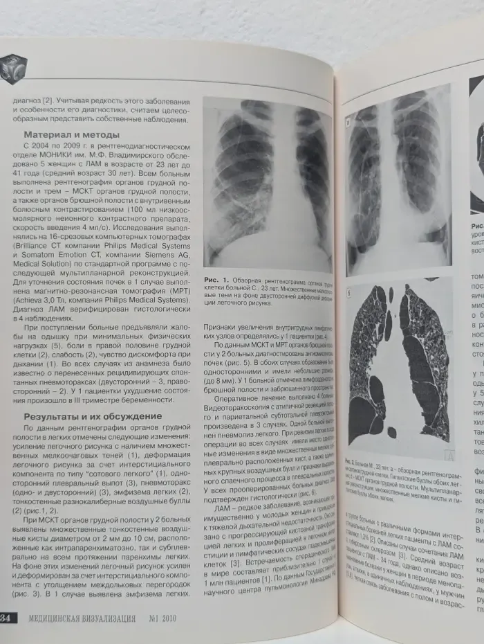 Медицинская визуализация. Выпуск № 1/2010