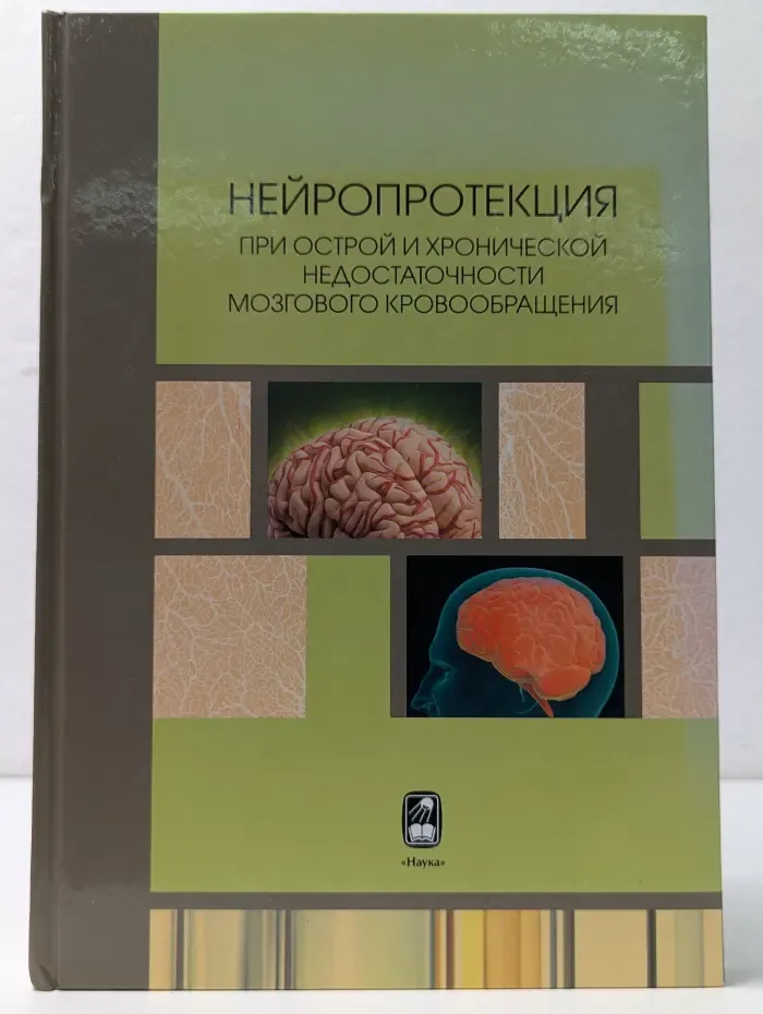 Нейропротекция при острой и хронической недостаточности мозгового кровообращения
