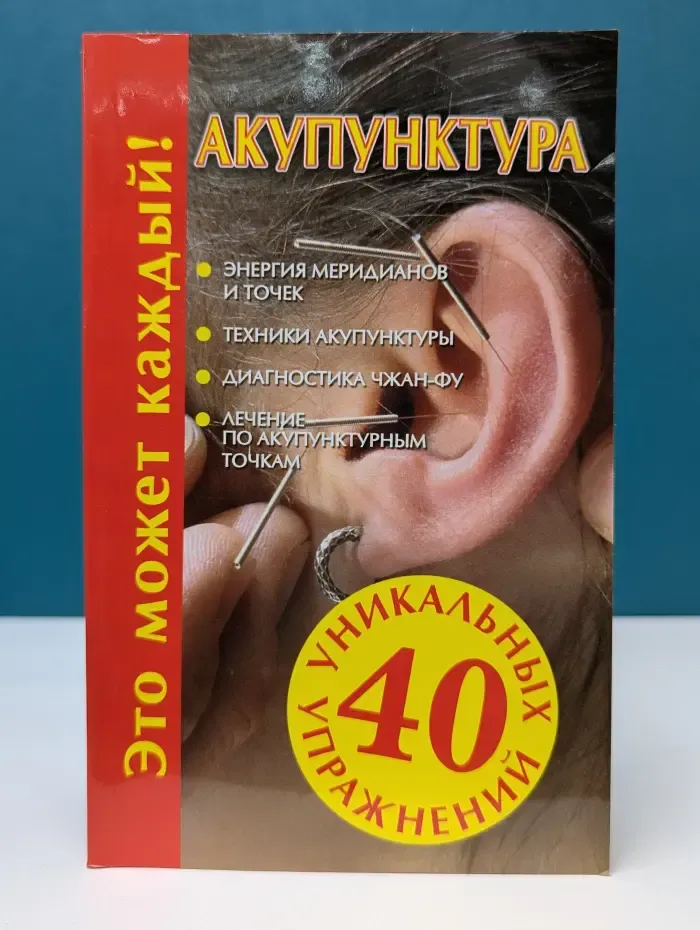 Акупунктура